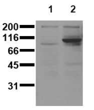 AM00151PU-N - STAT6