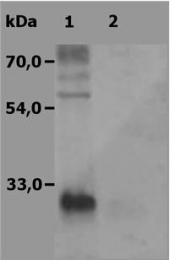 AP03005PU-N - LAT2 / WBSCR15