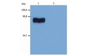AM03106PU-N - STIM1 / GOK