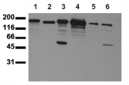 AM00052PU-N - CD340 / ERBB2 / HER2