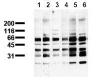AM00118PU-N - Phosphoserine