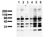 AM00114PU-N - Phosphoserine
