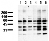AM00112PU-N - Phosphoserine