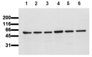 AM00110PU-N - AKT1 / PKB