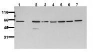 AM00109PU-N - AKT2 / PKB beta