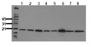 AM00104PU-N - PIN1