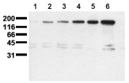 AM00051PU-N - CD340 / ERBB2 / HER2