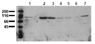 AM00018PU-N - Catenin beta-1