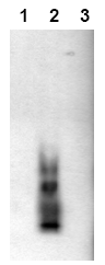 AM00003BT-N - Amyloid beta