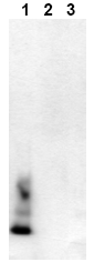 AM00001BT-N - Amyloid beta