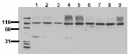 AM00059PU-N - FAK1 / PTK2
