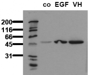 AM00065PU-N - GSK3 alpha