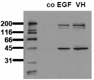AM00067PU-N - GSK3 beta