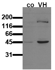 AM00068PU-N - GSK3 beta