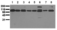 AM00072PU-N - CD221 / IGF1R