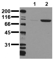AM00075PU-N - CD220 / INSR