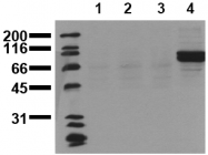 AM00076PU-N - CD220 / INSR