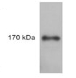 SP5173P - IRS1