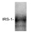SP5168P - IRS1