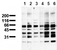 AM00117PU-N - Phosphoserine