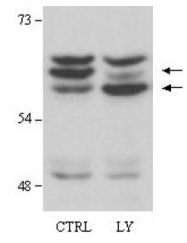 R1467 - AKT2 / PKB beta