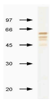AM00953PU-N - Influenza B