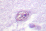 AP06583PU-N - SOX9