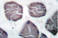 AP06002PU-N - gamma 2 smooth muscle Actin / ACTG2