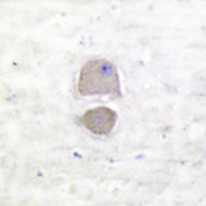 AP06027PU-N - Bax