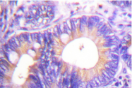 AP06427PU-N - CBL / RNF55