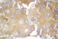 AP06691PU-N - FRK / PTK5