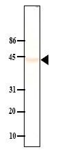 SM6005 - Protein phosphatase 1A / PPM1A
