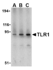 AP05230PU-N - CD281 / TLR1