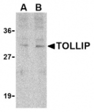 AP05245PU-N - TOLLIP