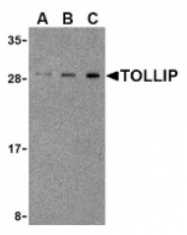AP05246PU-N - TOLLIP