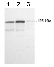 AM05355PU-N - FAK1 / PTK2