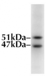 AM05356PU-N - GSK3 alpha