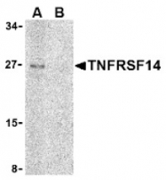 AP05251PU-N - TNFRSF14 / HVEM