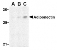 AP05253PU-N - Adiponectin