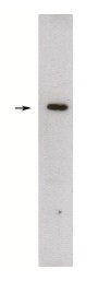 AP05254PU-N - Sphingosine kinase 1 (SPHK1)