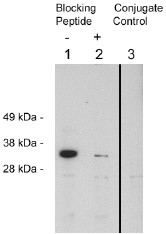 AP05258SU-N - FHL2 / SLIM3