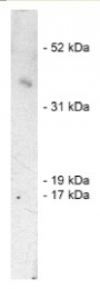 AP05260PU-N - SIAH1