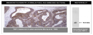 AM05382PU-N - TIMP2