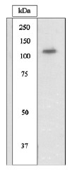 AP05272PU-N - Tyrosine-protein kinase JAK1