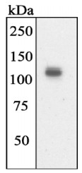 AP05273PU-N - Tyrosine-protein kinase JAK2