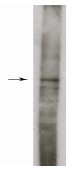 AP05277PU-N - Sphingosine kinase 1 (SPHK1)