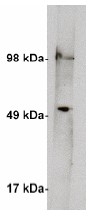 AP05280PU-N - SPTLC1