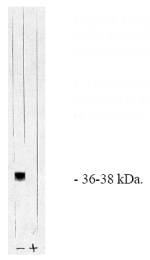 AP05032PU-N - PPP1CA