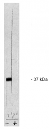 AP05034PU-N - PPP1CB