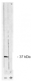 AP05036PU-N - PPP1CC